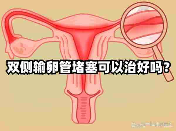 输输道解管道术析（输卵管解剖位置示意图）