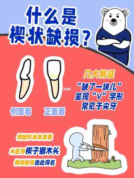 发交状发状现发展的简单介绍